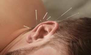 acupuntura en la oreja y su significado