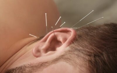 Puntos de acupuntura en la oreja y su significado para el bienestar