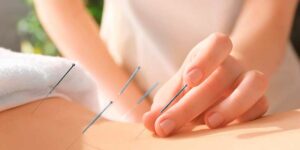 Estudiar acupuntura para formarte en terapias naturales.