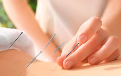 Estudiar acupuntura: qué necesitas aprender