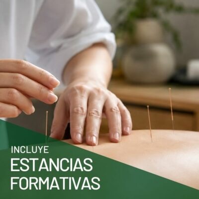 Especialízate en la técnica propia de la medicina tradicional china con la formación Acupuntura que incluye estancias formativas en el sector