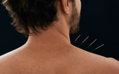 Puntos Shu en acupuntura: qué son y cómo utilizarlos